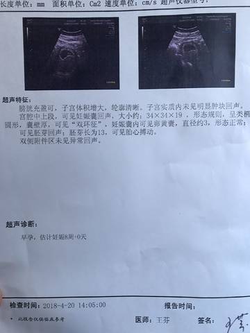 journal_insert_pic_993924421