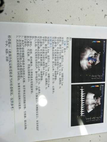 journal_insert_pic_994634507