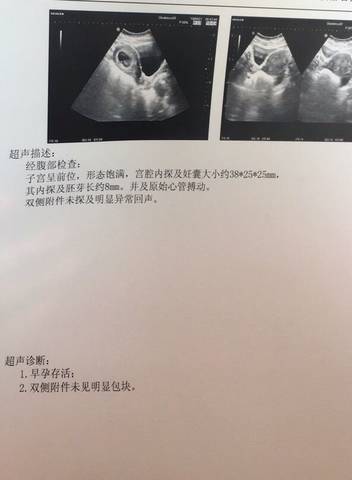 journal_insert_pic_994701210