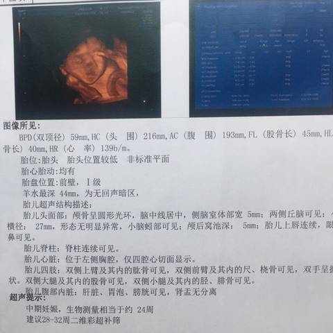 journal_insert_pic_995205707