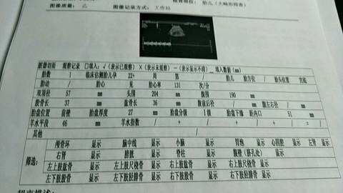 journal_insert_pic_996397597