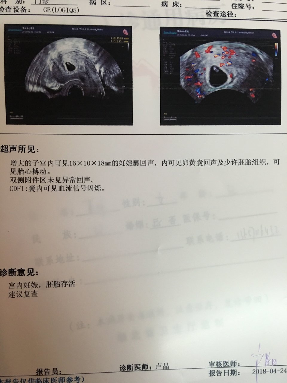 孕42天，B超已见胎心