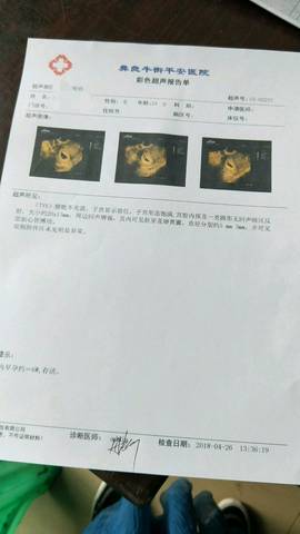 journal_insert_pic_998502918