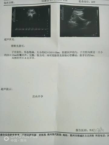journal_insert_pic_998149045