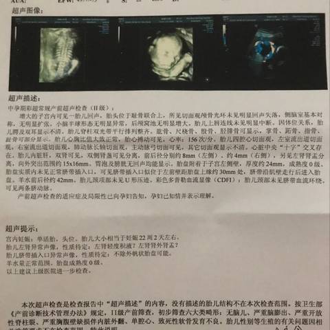 journal_insert_pic_998264439