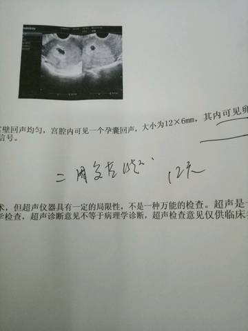 journal_insert_pic_999796357