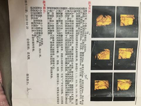 journal_insert_pic_999829296