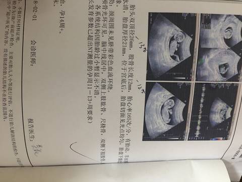 journal_insert_pic_999829249