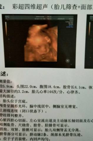 journal_insert_pic_1000732058