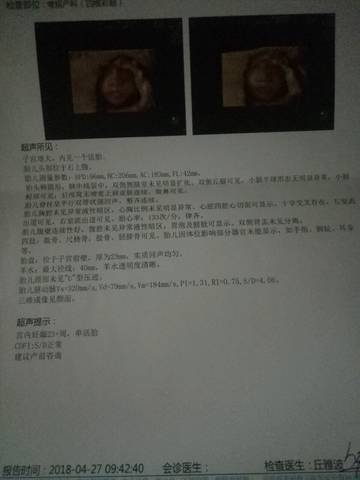 journal_insert_pic_1001739482