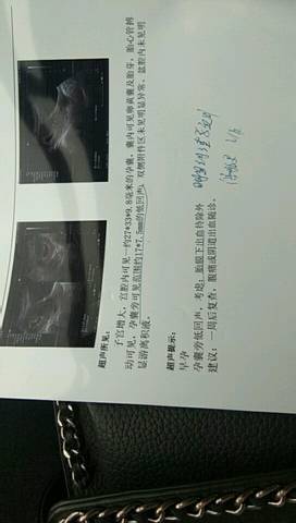 journal_insert_pic_1002309551