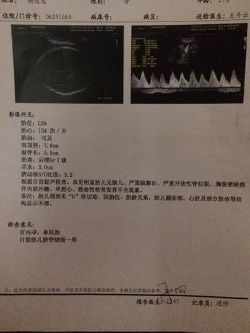 journal_insert_pic_1002987961