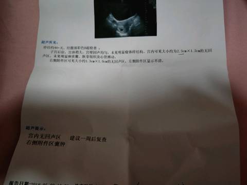 journal_insert_pic_1003654566