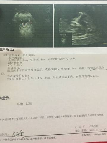journal_insert_pic_1004356506