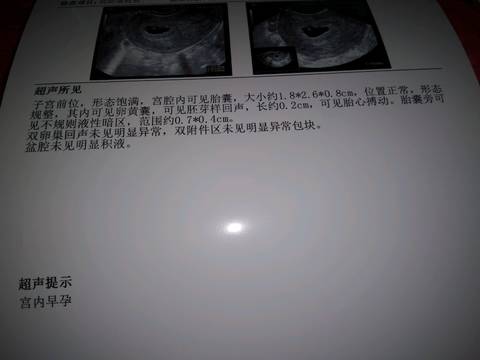 journal_insert_pic_1004333283