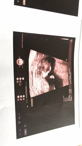 journal_insert_pic_1004684377