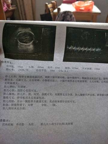 journal_insert_pic_1004815022