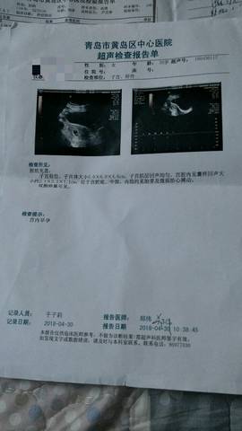 journal_insert_pic_1006766658