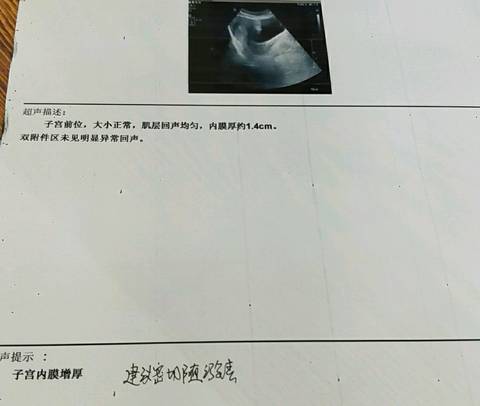 journal_insert_pic_1006604502