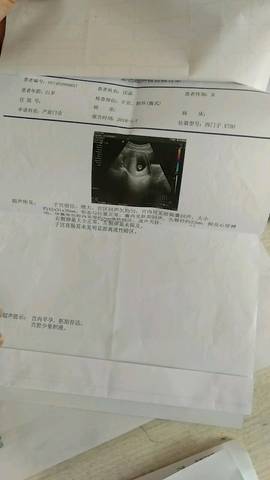 journal_insert_pic_1007813378