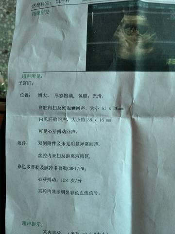 journal_insert_pic_1008040801