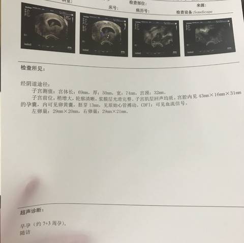 journal_insert_pic_1008684195
