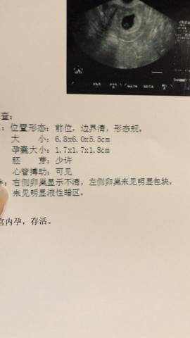 journal_insert_pic_1008712408