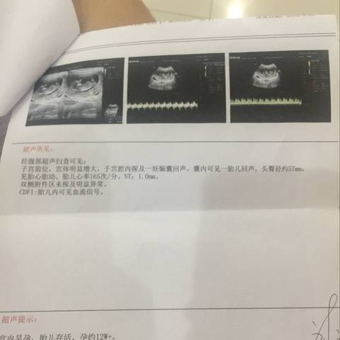 journal_insert_pic_1010624654