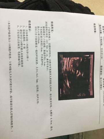 journal_insert_pic_1011343371
