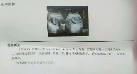journal_insert_pic_1012511761