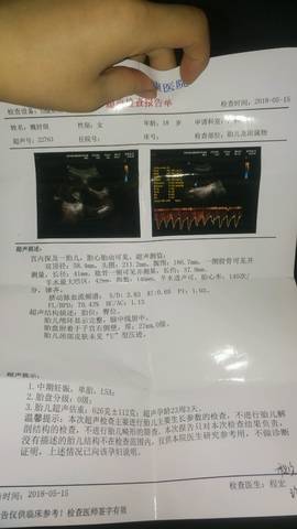 journal_insert_pic_1012933105