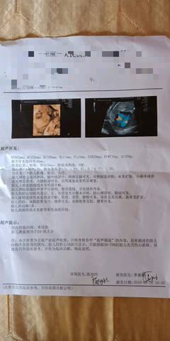 journal_insert_pic_1012967474