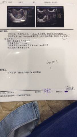 journal_insert_pic_1016570715