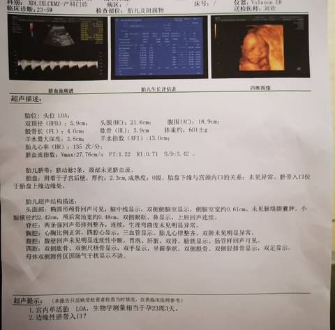 journal_insert_pic_1016915291