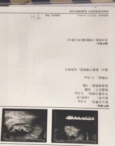 journal_insert_pic_1019967128