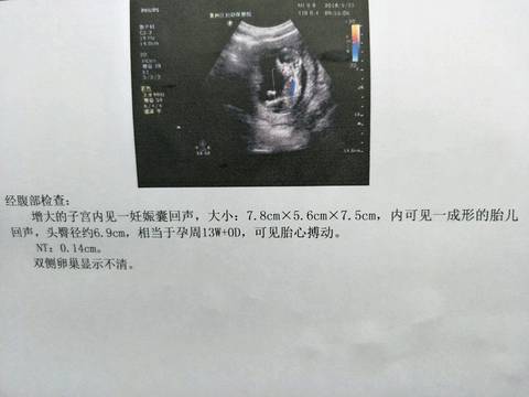journal_insert_pic_1019759562