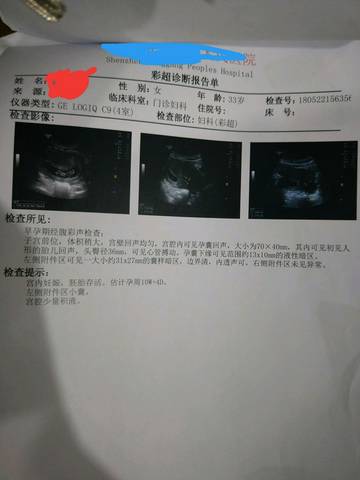 journal_insert_pic_1020950589