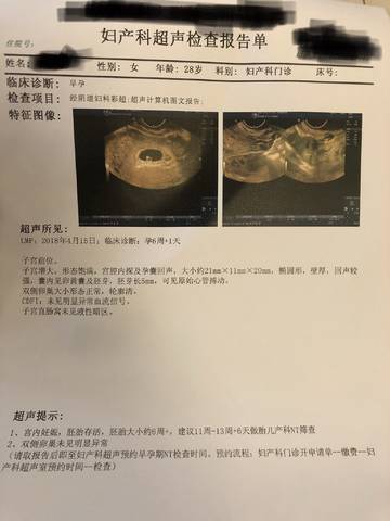 journal_insert_pic_1021831480