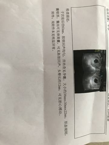 journal_insert_pic_1021736976