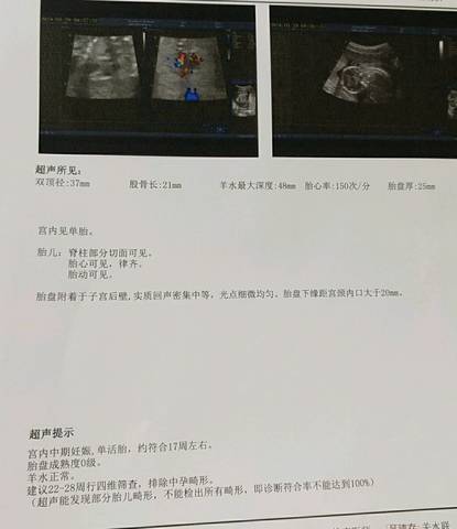 journal_insert_pic_1022482504