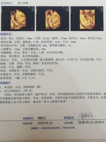 journal_insert_pic_1022589553