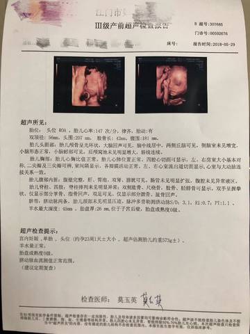 journal_insert_pic_1022638928
