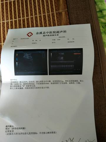 journal_insert_pic_1023949143