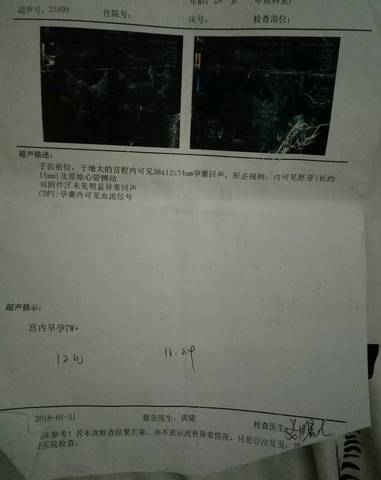 journal_insert_pic_1024516090