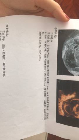 journal_insert_pic_1024869894