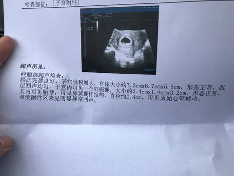 journal_insert_pic_1025458760