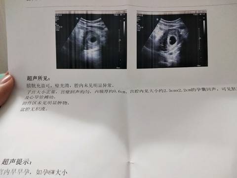 journal_insert_pic_1026492804