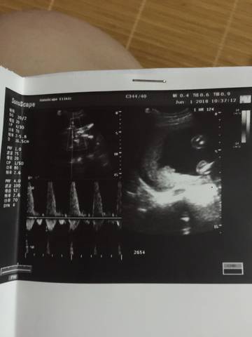 journal_insert_pic_1026142741