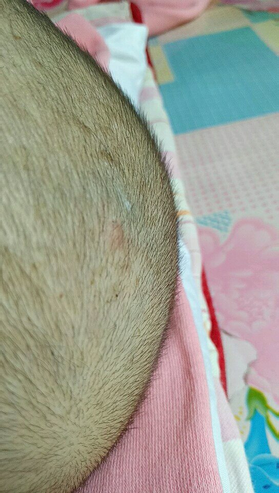 五个半月宝宝脸上鼓水泡状痘痘是什么