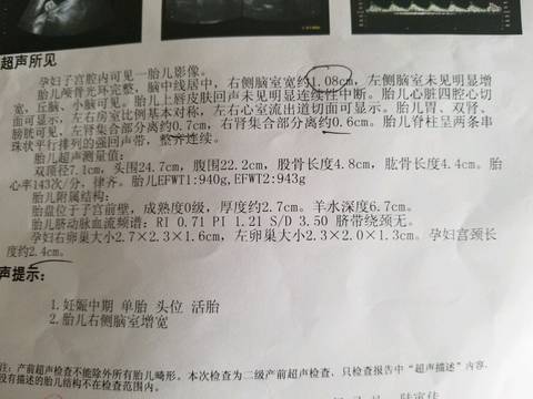 journal_insert_pic_1028936722